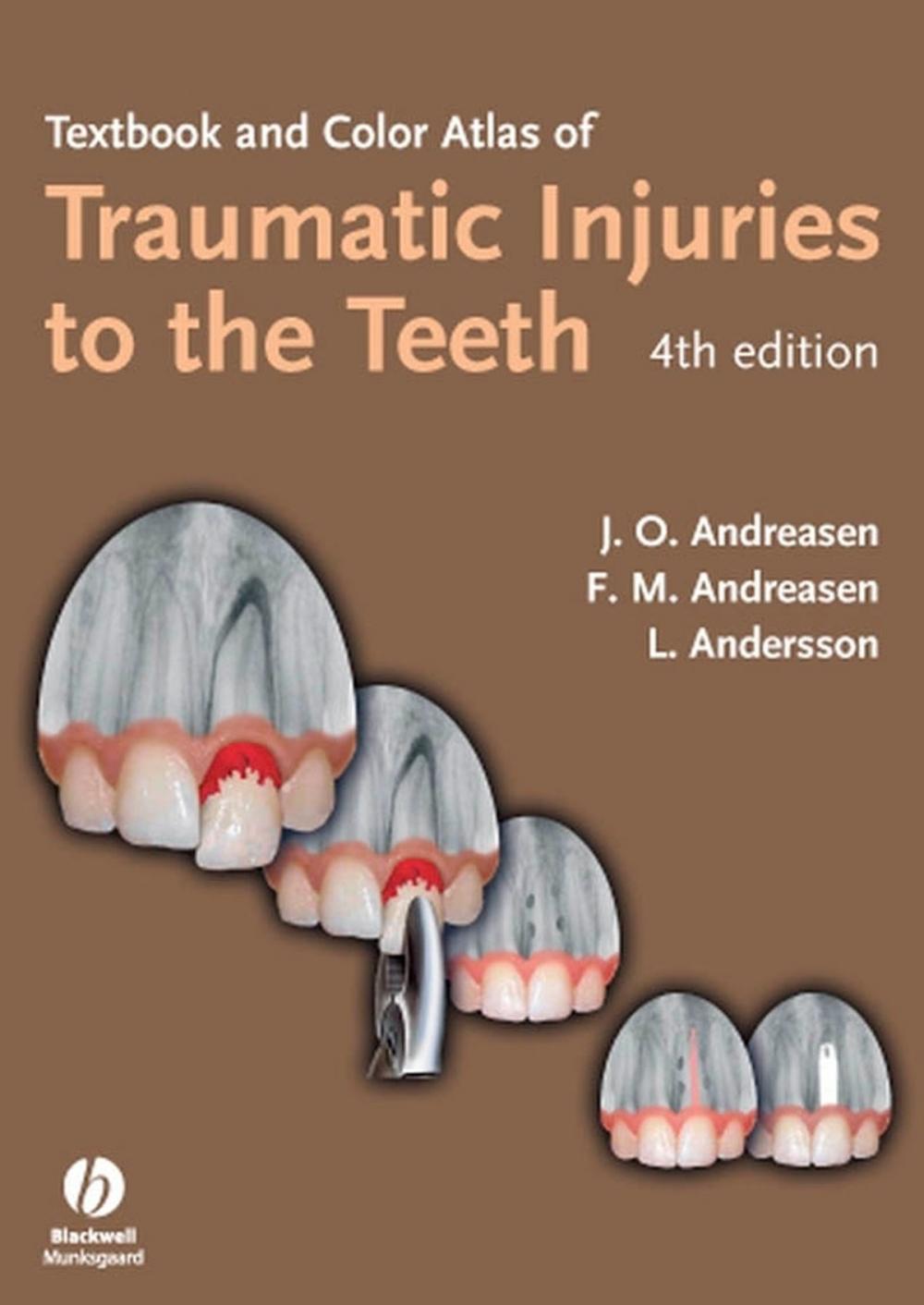 Big bigCover of Textbook and Color Atlas of Traumatic Injuries to the Teeth