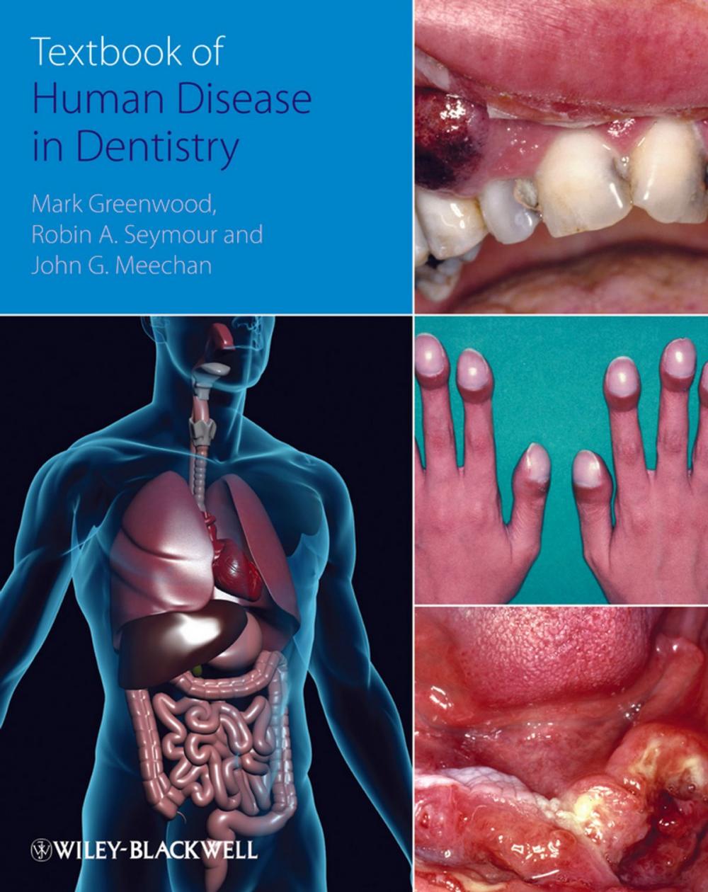 Big bigCover of Textbook of Human Disease in Dentistry