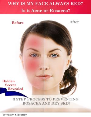 Cover of the book Why is my face always red? Is it Acne or Rosacea?: 3 step process to preventing Rosacea and Dry Skin by Helen Lee