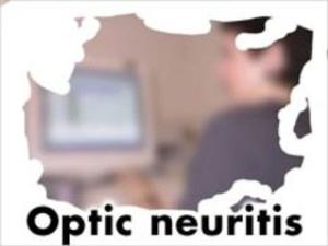 Cover of Optic Neuritis: Causes, Symptoms and Treatments