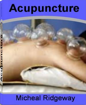 Book cover of Acupuncture