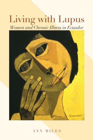 Cover of the book Living with Lupus by Charles Burkhart