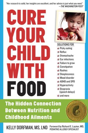 Cover of the book Cure Your Child with Food by Marti Olsen Laney Psy.D.