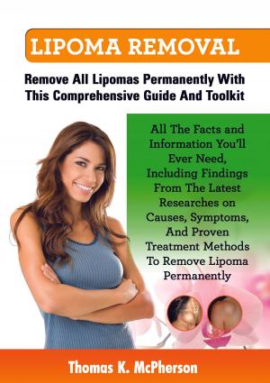 Cover of the book Lipoma Removal by Connie Bus
