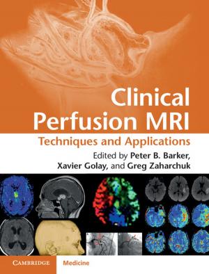 Cover of the book Clinical Perfusion MRI by Christopher Earls Brennen