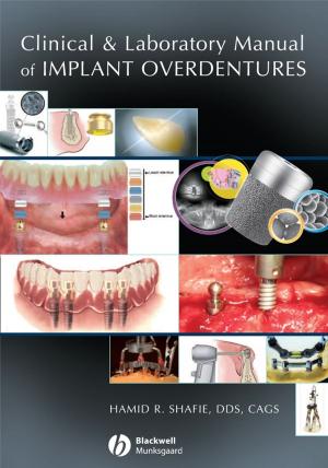 Cover of the book Clinical and Laboratory Manual of Implant Overdentures by 