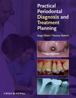 Cover of the book Practical Periodontal Diagnosis and Treatment Planning by Barry J. Maron, Lisa Salberg