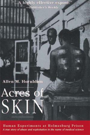Book cover of Acres of Skin