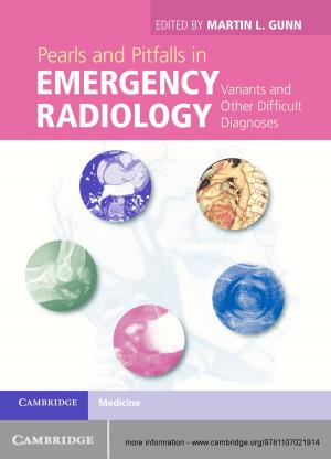 Cover of the book Pearls and Pitfalls in Emergency Radiology by Dilip Madan, Wim Schoutens