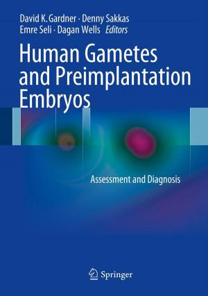 bigCover of the book Human Gametes and Preimplantation Embryos by 