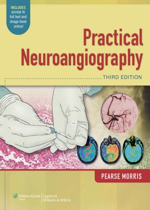 Cover of the book Practical Neuroangiography by Julio Banacloche Palo, Ignacio José Cubillo López