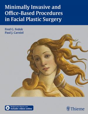 Cover of the book Minimally Invasive and Office-Based Procedures in Facial Plastic Surgery by Robert F. Spetzler, Wolfgang T. Koos, B. Richling