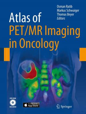 Cover of the book Atlas of PET/MR Imaging in Oncology by A. Labhart, H. Bürgi, G.R. Constam, B. Courvoisier, J.A. Fischer, E.R. Froesch, P. Grob, C. Hedinger, P.J. Keller, G. Kistler, G. Martz, J. Müller, A. Prader, P.H. Rossier, W.E. Schreiner, R. Siebenmann, H. Steiner, G. Töndury, M. Wernly, M. Zachmann, W. Ziegler