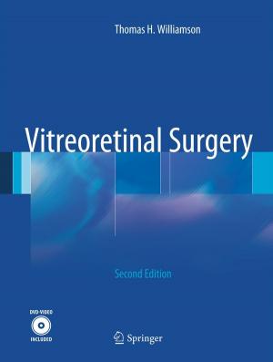 Cover of the book Vitreoretinal Surgery by Nicolas Hoffmann, Birgit Hofmann