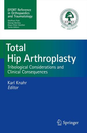 Cover of the book Total Hip Arthroplasty by F. Hajos, E. Basco