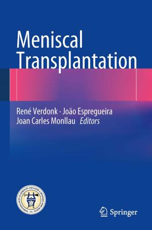 Cover of the book Meniscal Transplantation by Christel Kumbruck, Wibke Derboven