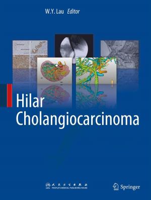 Cover of the book Hilar Cholangiocarcinoma by M.C. Bateson, I. Bouchier