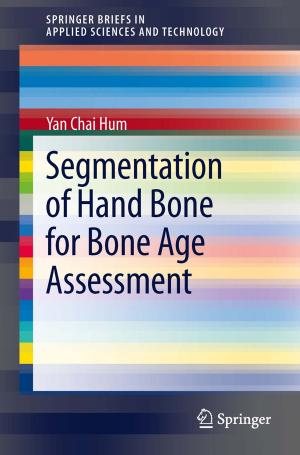 Book cover of Segmentation of Hand Bone for Bone Age Assessment