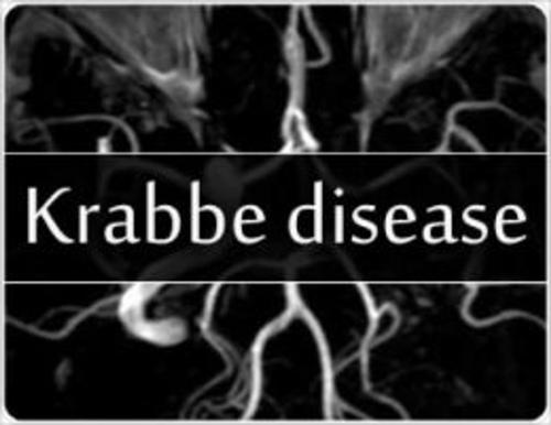 Cover of the book Krabbe Disease: Causes, Symptoms and Treatments by Jasmin Arruda, Axel Publishing