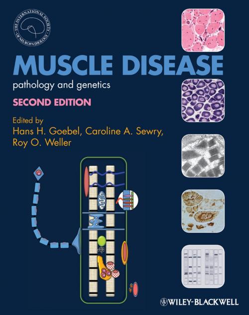 Cover of the book Muscle Disease by , Wiley