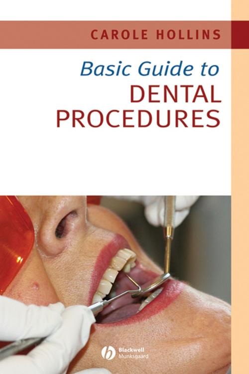 Cover of the book Basic Guide to Dental Procedures by Carole Hollins, Wiley
