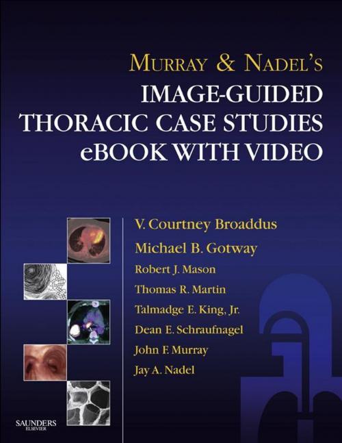 Cover of the book Murray & Nadel’s Image-Guided Thoracic Case Studies with Video by Robert J. Mason, V. Courtney Broaddus, Thomas Martin, Talmadge King Jr., Dean Schraufnagel, Jay A. Nadel, Elsevier Health Sciences