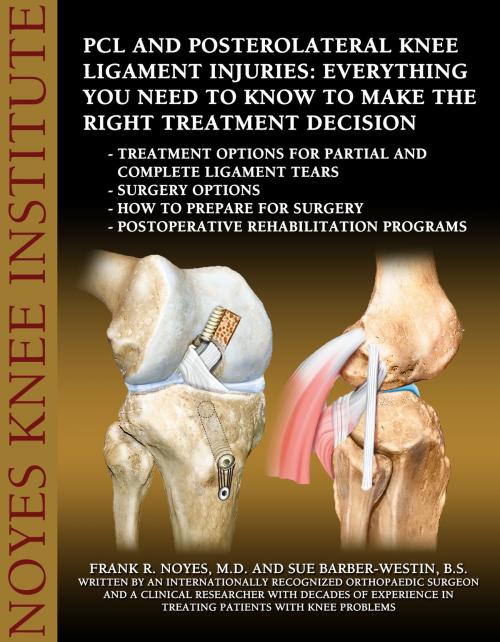 Cover of the book PCL and Posterolateral Knee Ligament Injuries: Everything You Need to Know to Make the Right Treatment Decision by Frank R. Noyes, M.D., Sue Barber-Westin, B.S., Publish Green