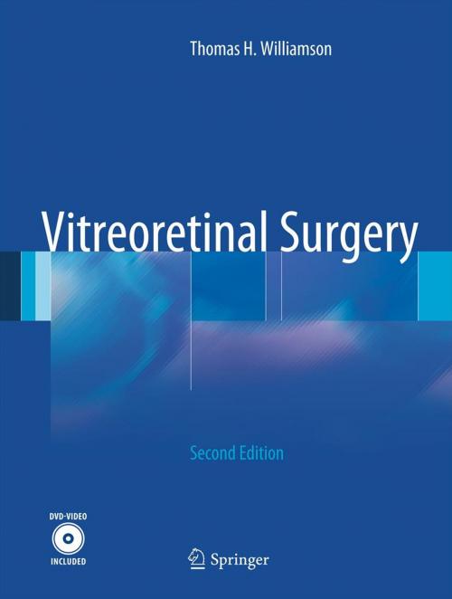Cover of the book Vitreoretinal Surgery by Thomas H. Williamson, Springer Berlin Heidelberg