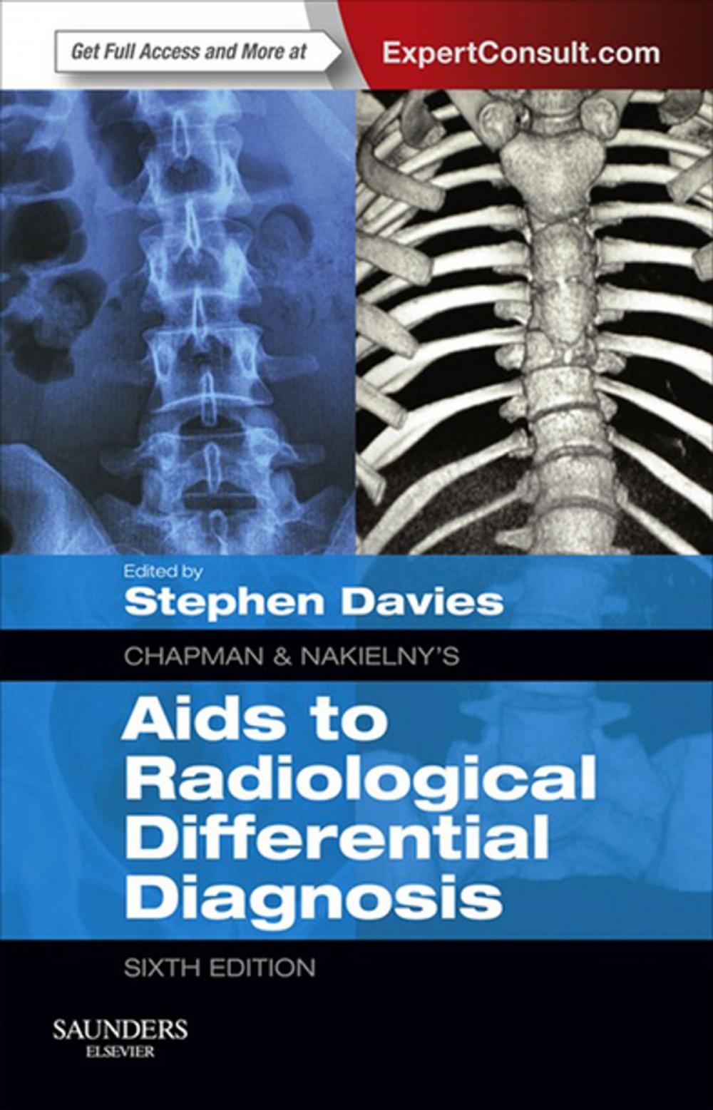 Big bigCover of Chapman & Nakielny's Aids to Radiological Differential Diagnosis E-Book
