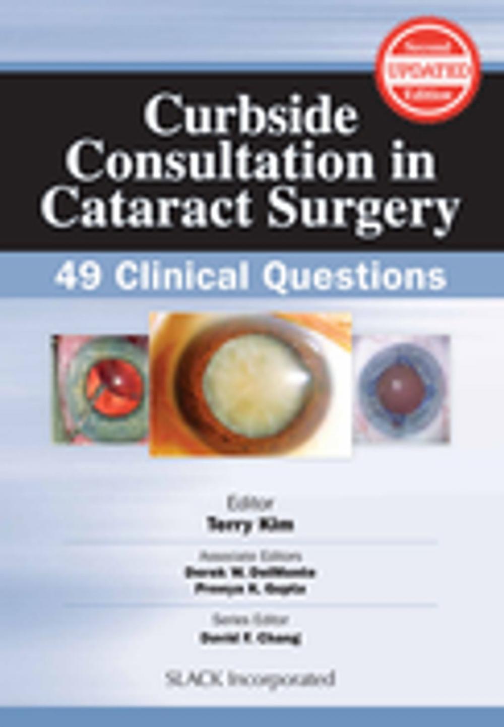 Big bigCover of Curbside Consultation in Cataract Surgery
