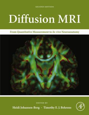 Cover of the book Diffusion MRI by Martin P. Bates