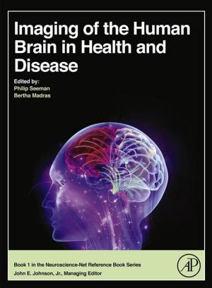 Cover of the book Imaging of the Human Brain in Health and Disease by Thomas J. Lewis, Clement L. Trempe, MD