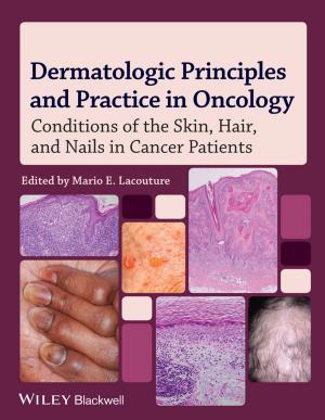 Cover of the book Dermatologic Principles and Practice in Oncology by Wendy Foster, Paulina Christensen, Anne Fox