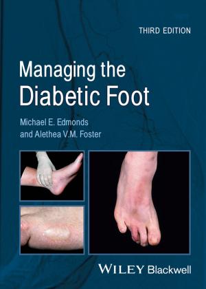 Book cover of Managing the Diabetic Foot