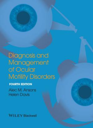Book cover of Diagnosis and Management of Ocular Motility Disorders