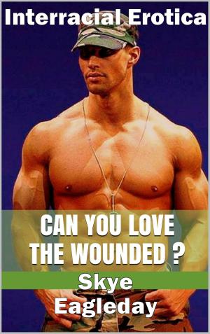 Cover of the book Can You Love The Wounded? (Interracial Erotica) by Skye Eagleday, Carl East