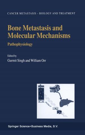 Cover of the book Bone Metastasis and Molecular Mechanisms by T. A. I. Bouchier Hayes, John Fry, Eric Gambrill, Alistair Moulds, K. Young