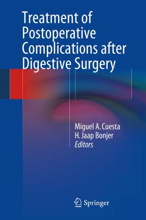 Cover of the book Treatment of Postoperative Complications After Digestive Surgery by Alexander Leff, Randi Starrfelt