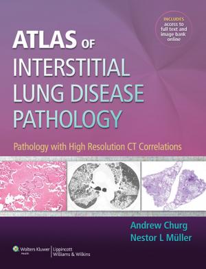Cover of the book Atlas of Interstitial Lung Disease Pathology by Christopher Dodson, David Dines, Joshua S. Dines, Gilles Walch, Gerald R. Williams