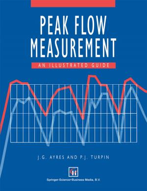 Cover of the book Peak Flow Measurement by Hyongsok T. Soh, Kathryn Wilder Guarini, Calvin F. Quate