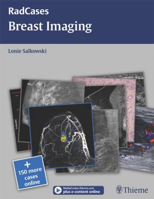 Cover of the book Breast Imaging by A. Leland Albright, Ian F. Pollack, P. David Adelson