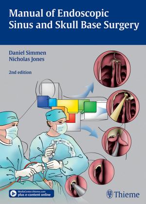Book cover of Manual of Endoscopic Sinus and Skull Base Surgery