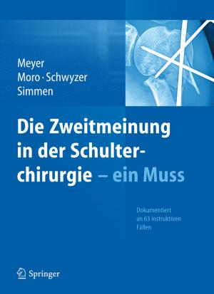 Cover of the book Die Zweitmeinung in der Schulterchirurgie - ein Muss by Salah Rubayi