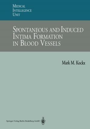 Cover of the book Spontaneous and Induced Intima Formation in Blood Vessels by J. Whitwam, Anne Pringle Davies, E. Geller, E. Keeffe, D. Fleischer, A. Maynard, N. Davies, D. Poswillo
