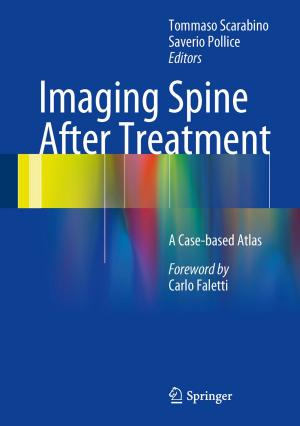 Cover of the book Imaging Spine After Treatment by Giorgio Gandellini, alberto pezzi, Daniela Venanzi