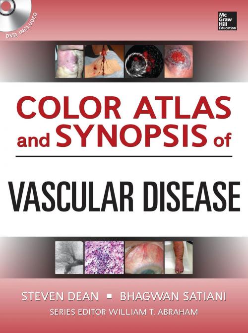 Cover of the book Color Atlas and Synopsis of Vascular Medicine (SET 2) by Steven Dean, Bhagwan Satiani, Mcgraw-hill