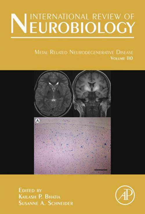 Cover of the book Metal Related Neurodegenerative Disease by Kailash P Bhatia, Susanne Schneider, Elsevier Science