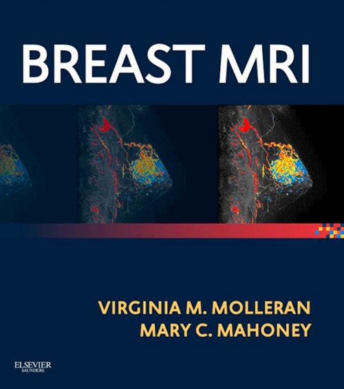 Cover of the book Breast MRI E-Book by Christiane Kuhl, MD, Mary C Mahoney, MD, Elsevier Health Sciences