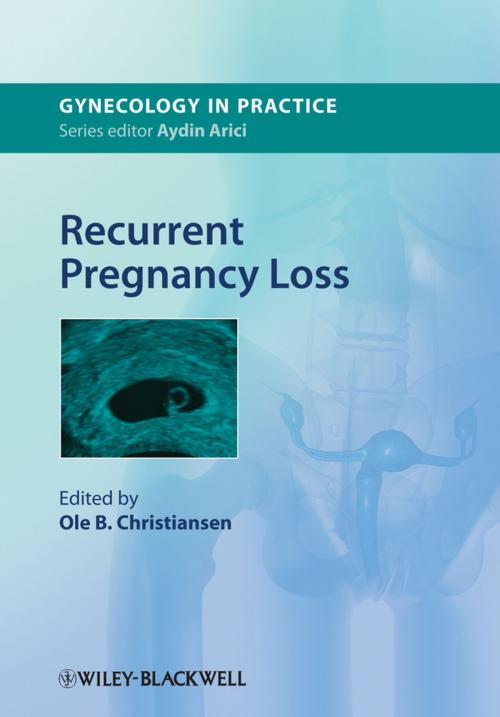 Cover of the book Recurrent Pregnancy Loss by , Wiley