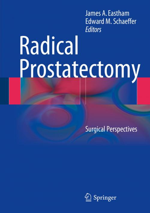 Cover of the book Radical Prostatectomy by , Springer New York